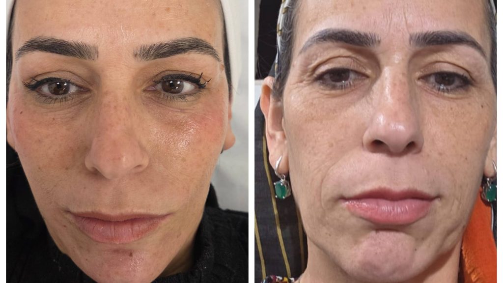 Collage_2026-01-21_18_29_00גג