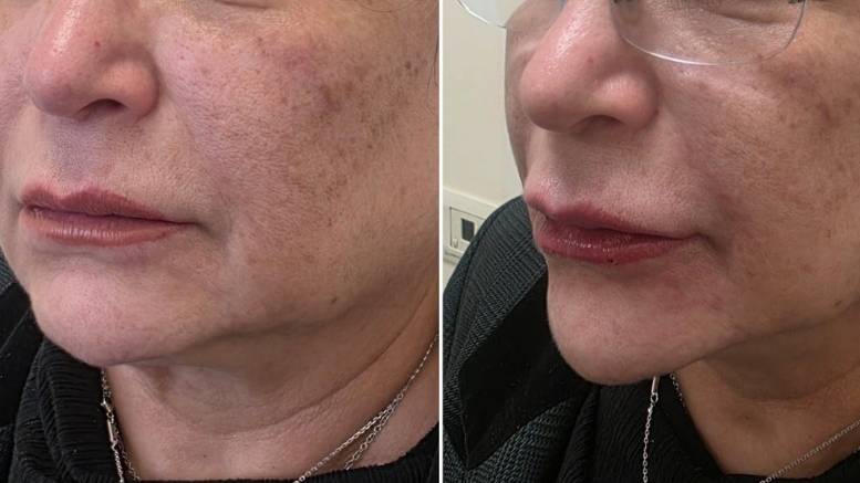 דר-שמואלביץ_לפני_ואחרי_