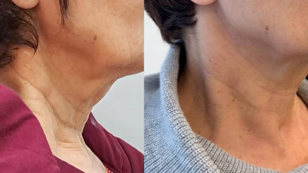 דר_שמואלביץ_לפני-ואחרי